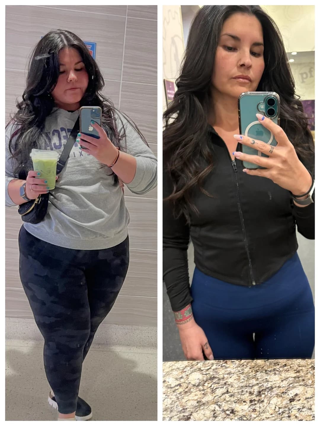 Before and after, front-facing.