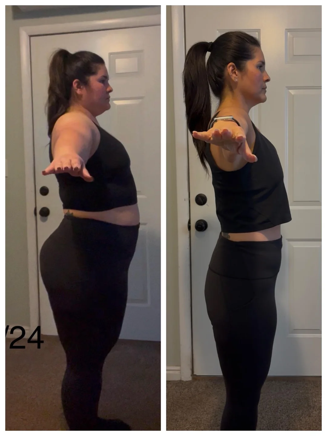 Side profile, before and after.